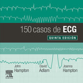 150 CASOS DE ECG - 9788491135043